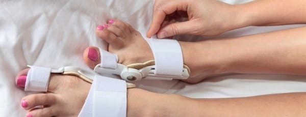 چه زمانی به جراحی بونیون یا‌ هالوکس والگوس نیاز است؟